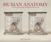 Human Anatomy: Stereoscopic Images of Medical Specimens