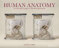 Human Anatomy: Stereoscopic Images of Medical Specimens