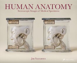 Human Anatomy: Stereoscopic Images of Medical Specimens