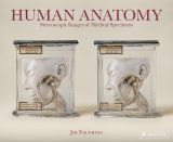 Human Anatomy: Stereoscopic Images of Medical Specimens